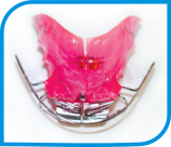 Ortopedia Facial