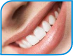 Instruções para Clareamento Dental